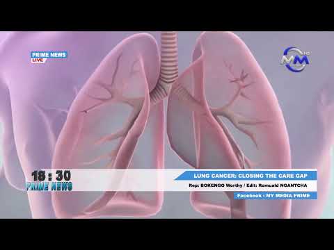 Prime News: Monday 8th August, 2022