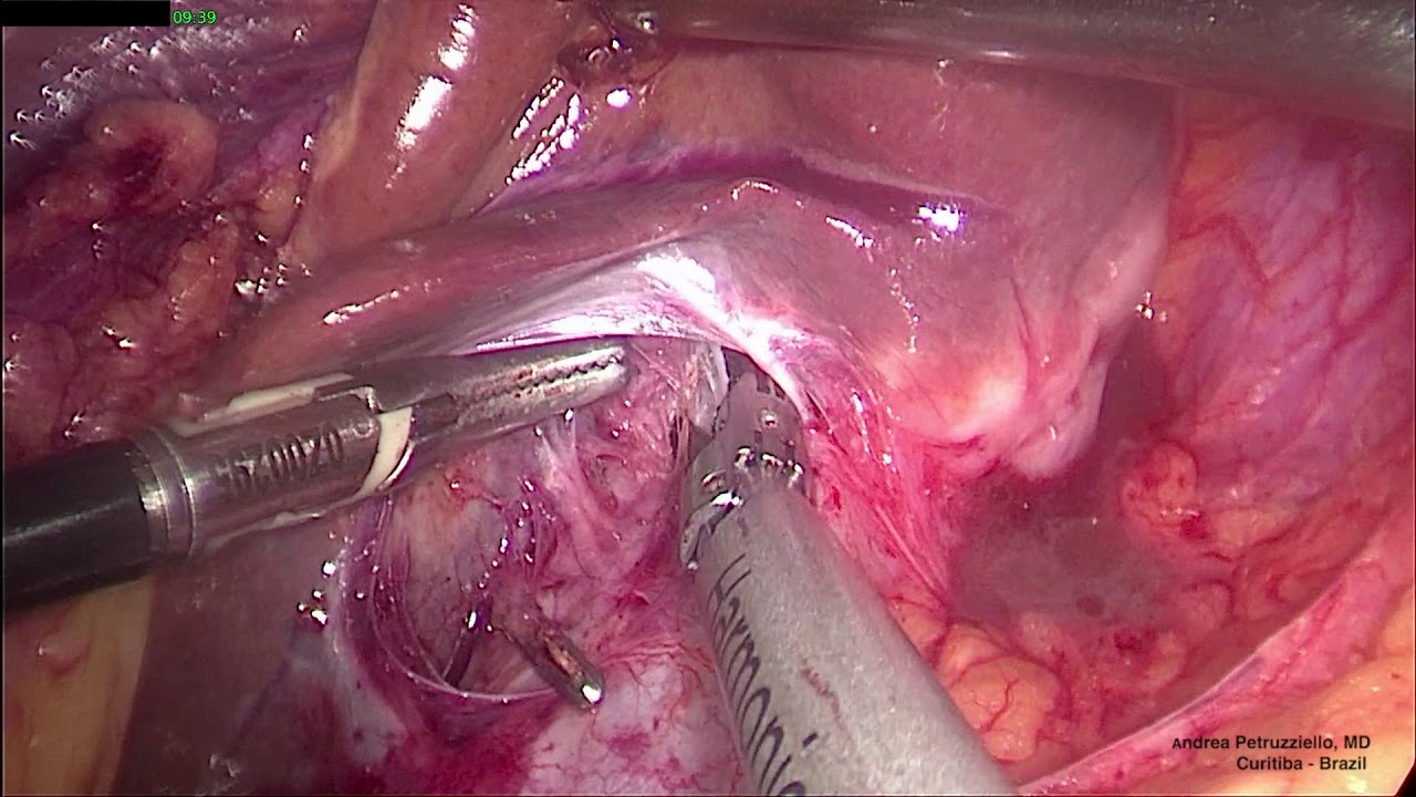 Andrea Petruzziello-7