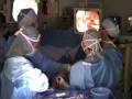 Video Assisted Thoracic Surgery (VATS)