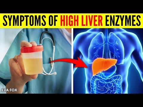 Signs and Symptoms of High Liver Enzymes Causes and Treatment
