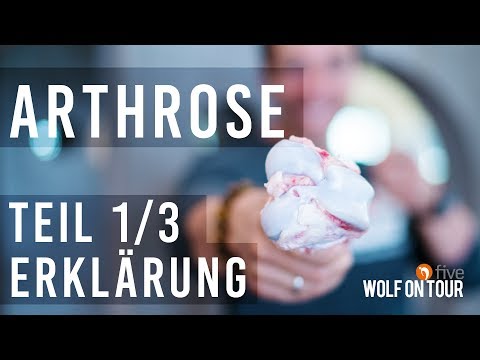 Vorbereitung von Gelenkschmerzen terafleks Hip beliebte Behandlungen