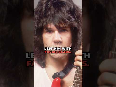 Why Did Gary Moore Have Scars On His Face? #garymoore #stillgottheblues #blues #rock #thinlizzy