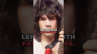 Why Did Gary Moore Have Scars On His Face? #garymoore #stillgottheblues #blues #rock #thinlizzy