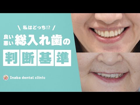 私はどっち？ 良い総入れ歯・悪い総入れ歯の判断基準