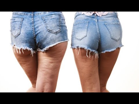 Glyukofazh 500 Long slimming review contraindications forum Kasaysayan nawala timbang ng 20 kg