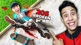 تحدي تكسير العظام الي يكسر عظمة اكثر يفوز ام كامل وسحس الفأر???????? - Skate