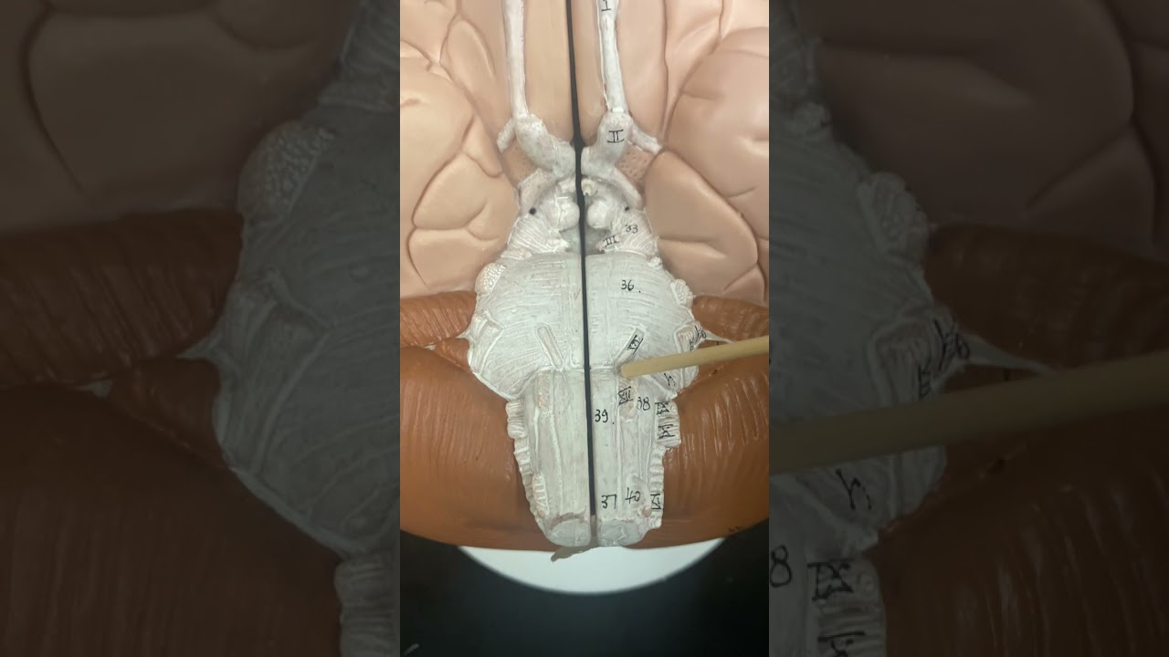 Inferior View of the Brain