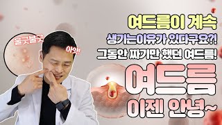 부위별 여드름