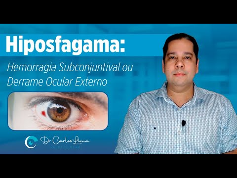 Hiposfagama: Hemorragia Subconjuntival ou Derrame Ocular Externo