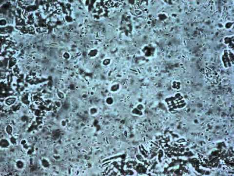 Histomonas meleagridis chicken