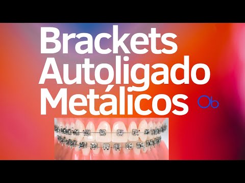 Brackets Autoligado metálicos