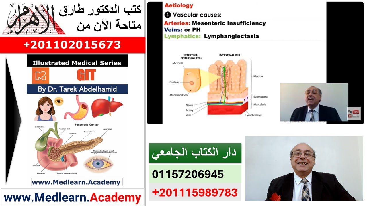 Malabsorption Syndrome  #cme #internal_medicine #medicalstudent #usmle #محاضرات_باطنة