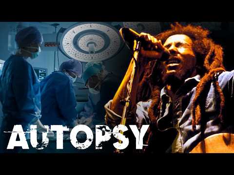 Was war die wahre Todesursache von Bob Marley? | Unsere Geschichte