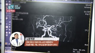 [JTV 1분 토크닥터] '뇌동맥류' 원광대학교병원 적정의료관리실장 김대원 교수 관련사진