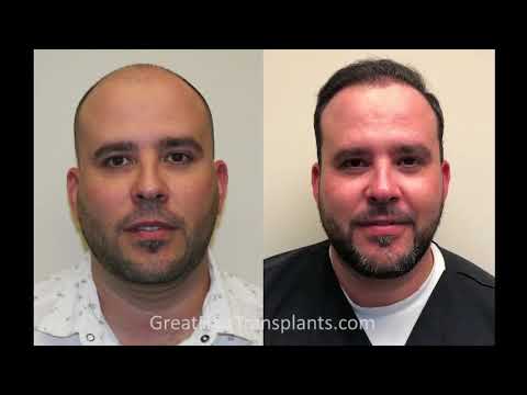 Dr. Brett Bolton Patient Adrien Surgery Day
