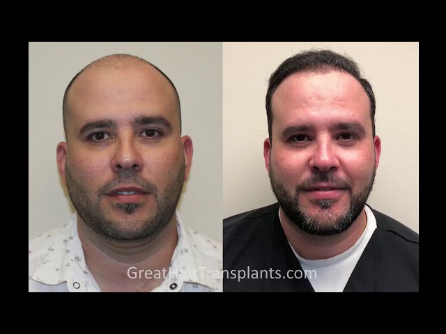 Dr. Brett Bolton Patient Adrien Surgery Day
