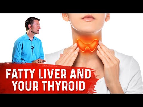 Hyperthyroid vs Hypothyroid Explained By Dr Berg