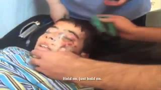 SNN   Syria   Homs   Doctors Distract Girl As Brother Takes Last Breaths   Sept 17, 2013   18+ ONLY