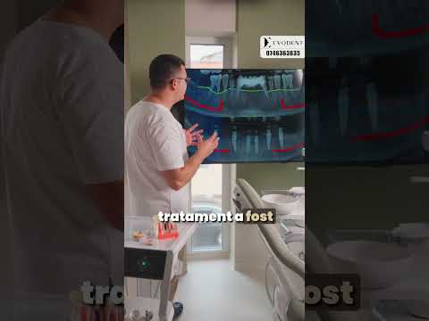 Dinți care nu mai țin? Cazul d. Gabriel