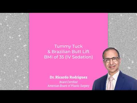 Video: Tummy tuck and Brazilian butt lift combination on high BMI patient | Ricardo L. Rodriguez MD, Baltimore Plastic Surgeon