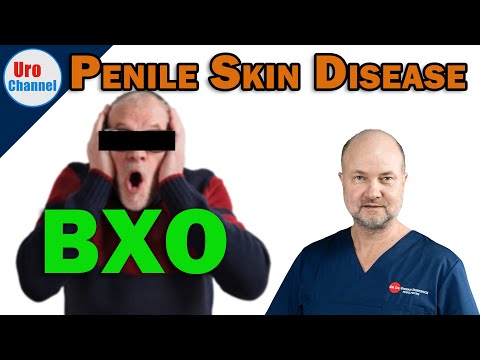 Is your penis at risk of Lichen sclerosus? | UroChannel