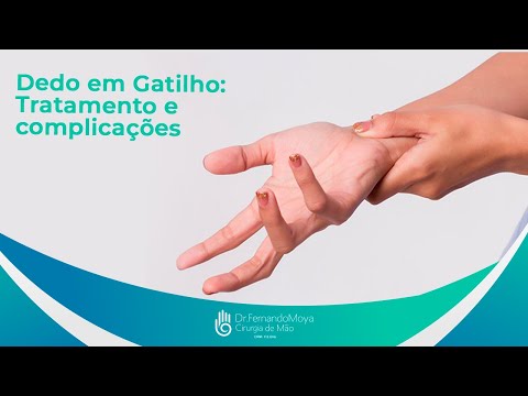 Dedo em Gatilho: Tratamento e complicações | Dr. Fernando Moya CRM 112046