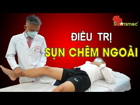 Sự Thật Về Chấn Thương Sụn Chêm Ngoài: Bạn Có Biết?