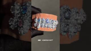 Download lagu Start the process with a mold kit now.  🦷🔥 mp3