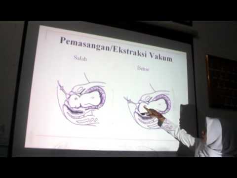 Dan Carr. cara mudah untuk menurunkan berat badan audiobook Cara menghapus kelebihan lemak di perut pria