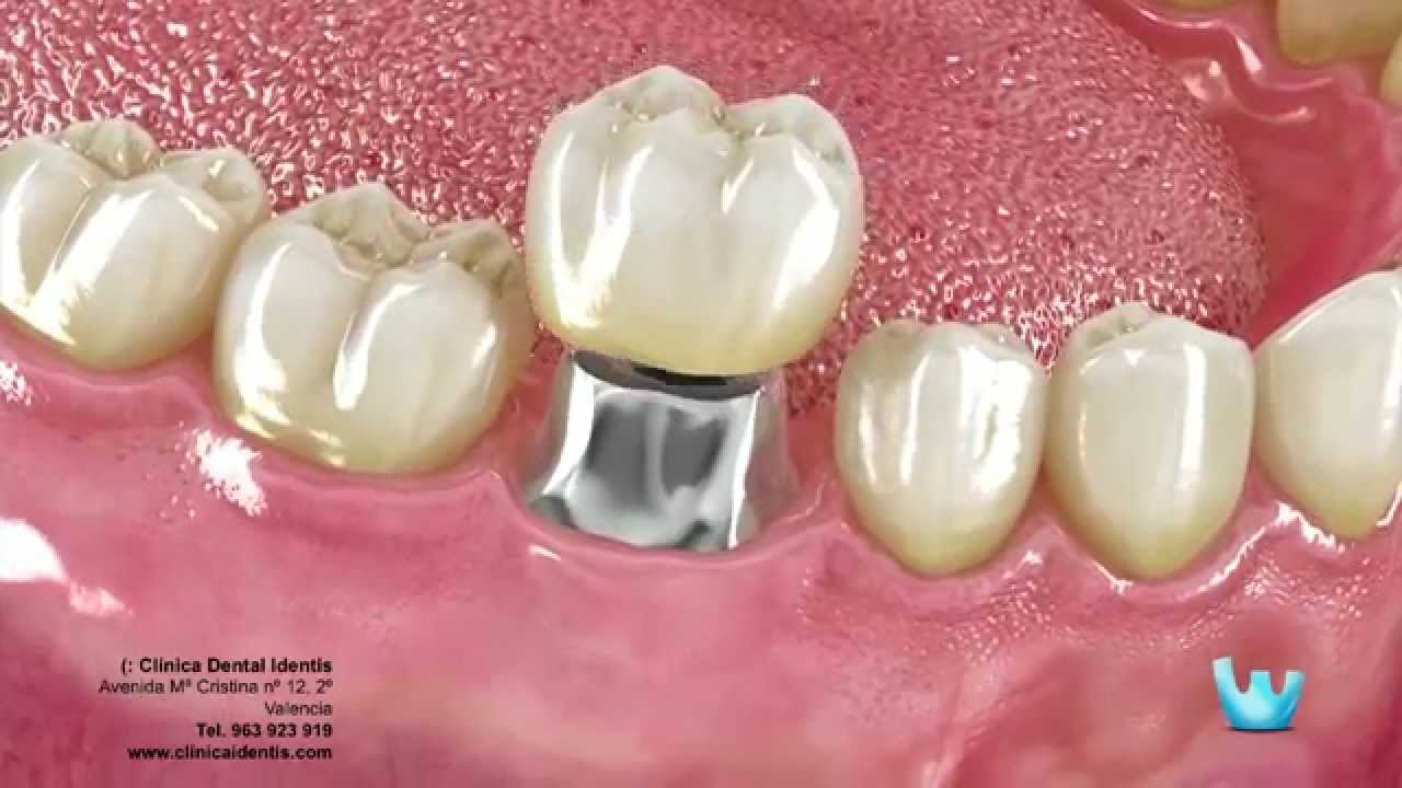 Jacqueline Molina Torres-10