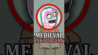 Medieval Eye Surgery Was Terrifying 👁️ 😰 #didyouknow #medieval #history #facts