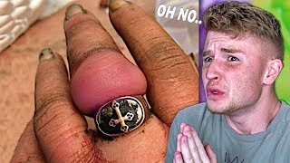 TINY Ring Gets STUCK On Girls FINGER..