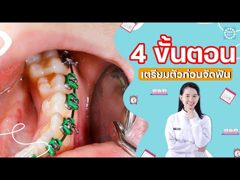 ขั้นตอน