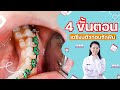 ขั้นตอน