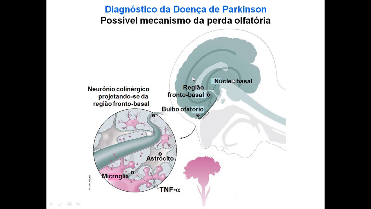 Aula5 - Doença de Parkinson