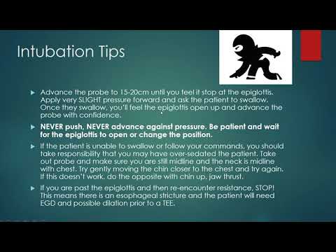 Transesophagreal Echocardiogram (TEE) Basics 4.