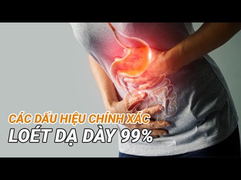 , title : 'Các dấu hiệu chính xác loét dạ dày 99%| Bác sĩ CKI Đồng Xuân Hà - Vinmec Hạ Long'