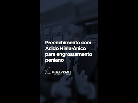 Preenchimento com Ácido Hialurônico para engrossamento peniano | Dr. Marco Túlio Cavalcanti