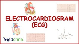 Electrocardiogram : (ECG/EKG) Basic concept,physiology,lead placement and interpretation