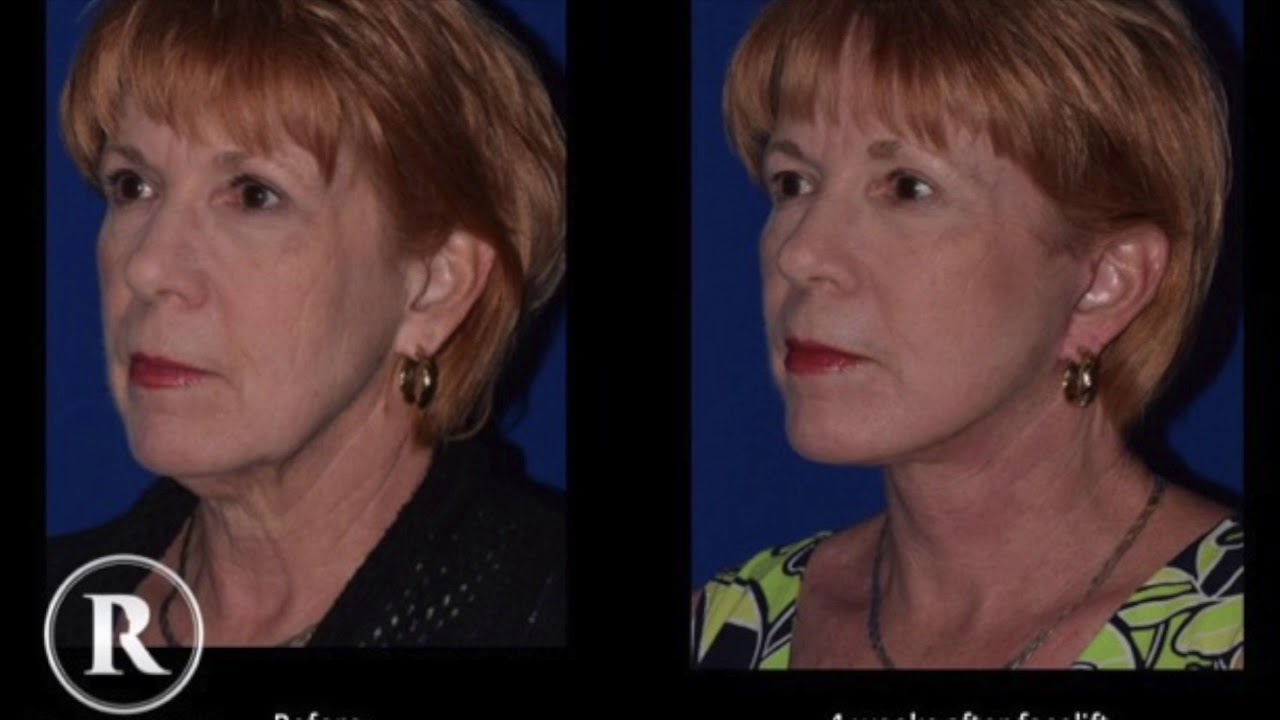 Robb Facial Plastic Surgery