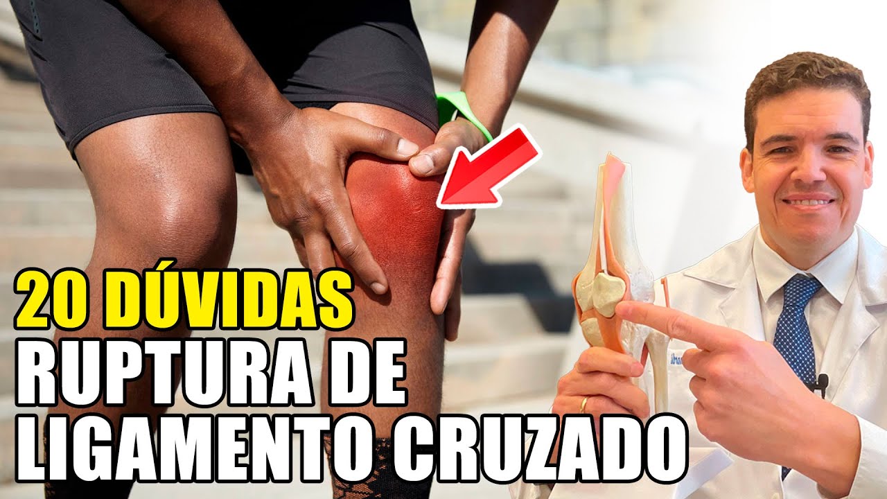 20 DÚVIDAS SOBRE RUPTURA DO LIGAMENTO CRUZADO ANTERIOR - LCA
