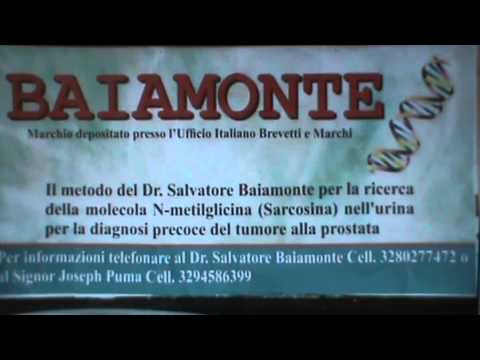Il cancro alla prostata se sia possibile bere alcolici Decotto di corteccia di pioppo con prostatite
