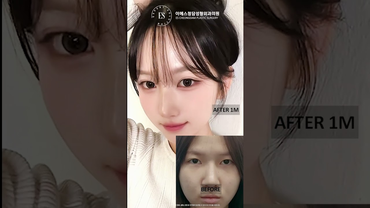 이에스 유튜브