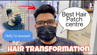 Sach Mein Natural Lagta Hai? | Hair Patch Result