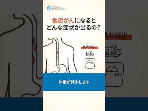 食道がんについて詳しく解説