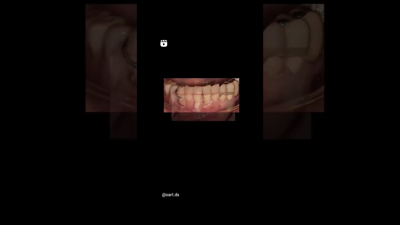 Oscar Justo Bustos-34