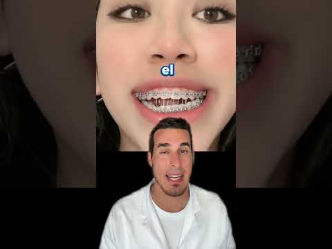 ¿TORTURA MEDIEVAL u ORTODONCIA? - Esto es una REJILLA LINGUAL