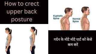 hump currection exercise #how to create upper back posture