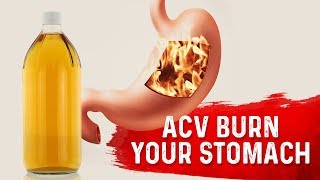 Does Apple Cider Vinegar Burn Your Stomach?