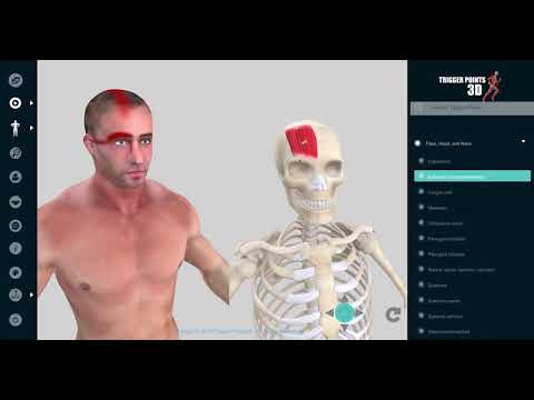 Trigger Point of the Week Occipitofrontalis